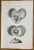 Ottavio Muzzi, Prostate Diseases, Lithograph, 1843 For Sale
