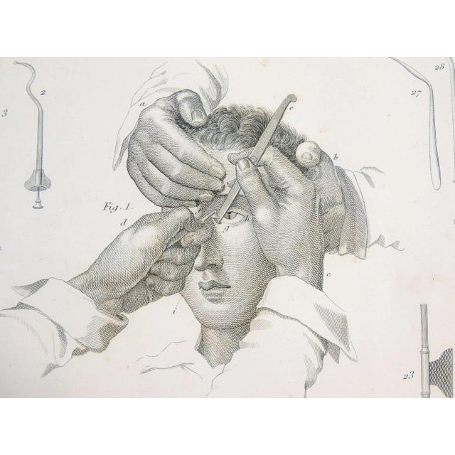 C. Pastore, Ophthalmic Surgery, Italy, 1800, Print For Sale - Image 3 of 7