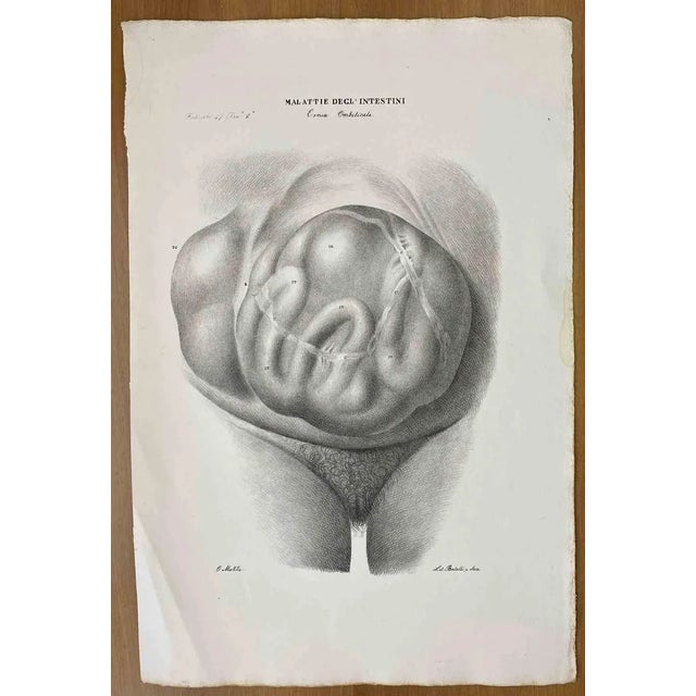 Ottavio Muzzi, Intestinal Diseases, Lithograph, 1843 For Sale