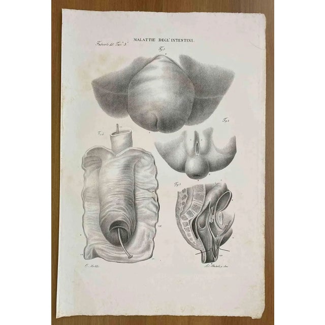 Ottavio Muzzi, Intestinal Diseases, Lithograph, 1843 For Sale