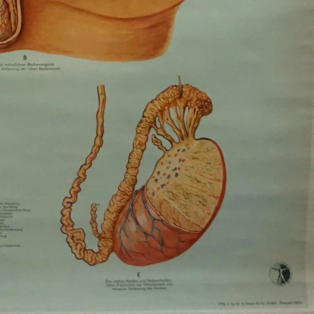 Vintage Male Pelvic Organs Medical Poster Pull Down Wall Chart For Sale - Image 6 of 7