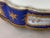 19thC Sevres Rococo Blue Porcelain Gallant Box - 1 For Sale - Image 15 of 16