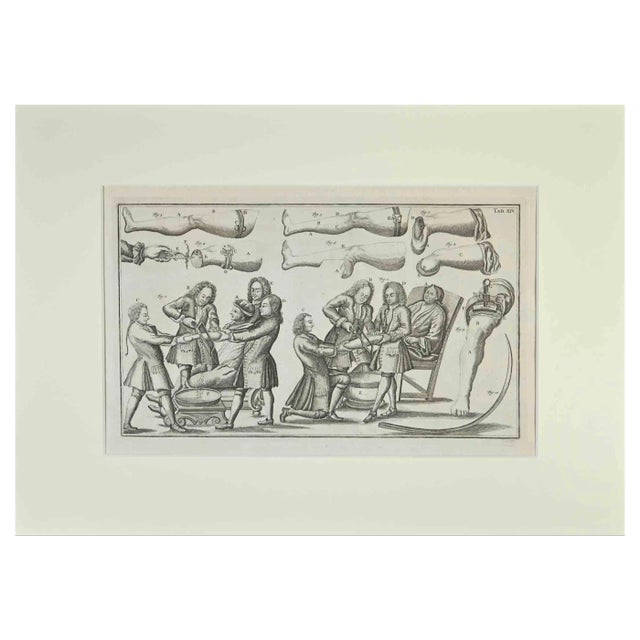 Lorenz Heister, Surgical Treatments, Etching, 1750 For Sale