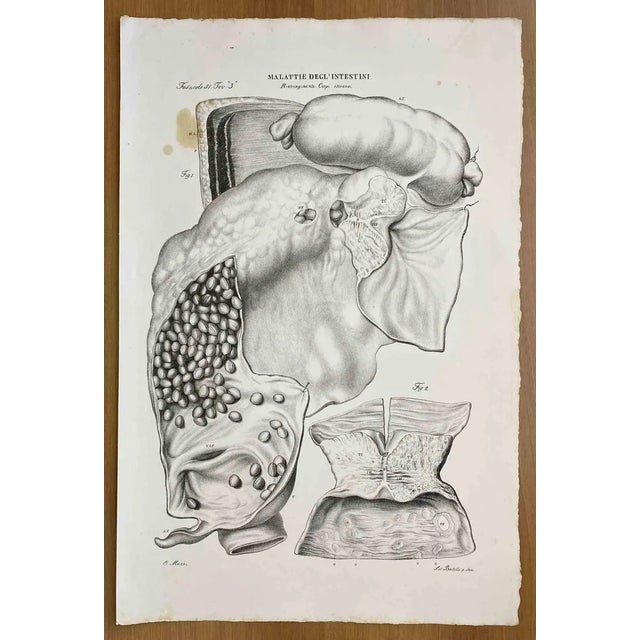 Ottavio Muzzi, Intestinal Diseases, Lithograph, 1843 For Sale