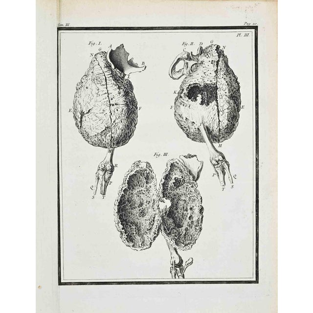 Jacques de Seve, Anatomical Studies, Etching, 1771 For Sale