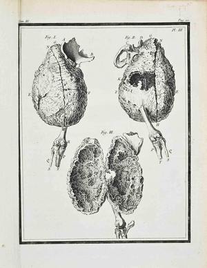 Jacques de Seve, Anatomical Studies, Etching, 1771