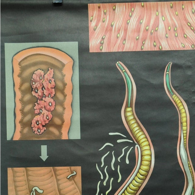 A traditional Jung Koch Quentell pull-down wall chart illustrating trichina (appearance and inner structure). Published by...