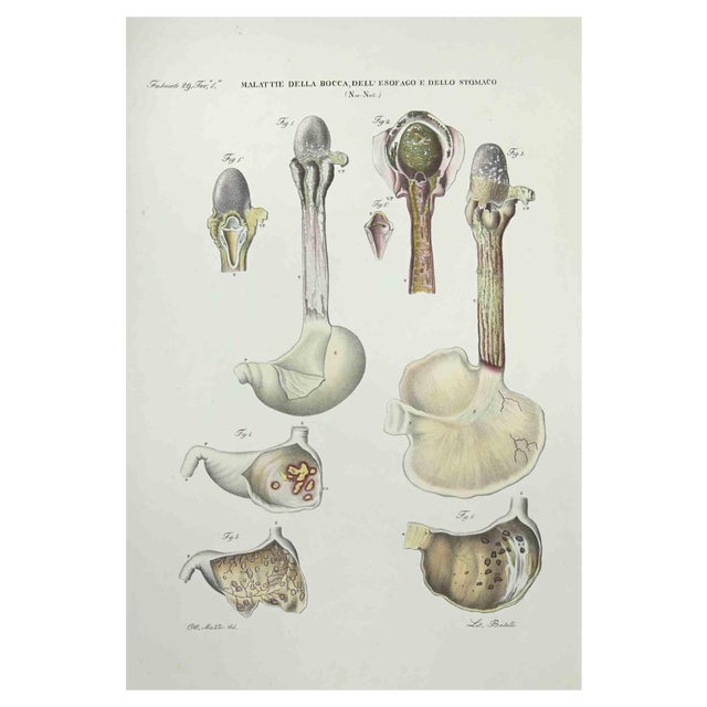Ottavio Muzzi, Mouth, Esophagus and Stomach Diseases, Lithograph, 1843 For Sale