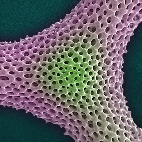 Photographer, Andrew Paul Leonard, uses the scanning electron microscope to explore “inner- space” as another fronitier....