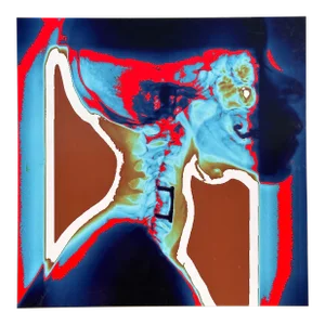 Modern Techno Skeleton Art of a Skull on Aluminum