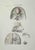 Brain Diseases is a lithograph hand colored by Ottavio Muzzi for the edition of Antoine Chazal, Human Anatomy, Printers...
