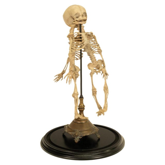 Wood Antique 19thC Anatomical Conjoined Syncephalus Twins Skeleton Medical Model 1860 For Sale - Image 7 of 17