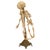 Antique 19thC Anatomical Conjoined Syncephalus Twins Skeleton Medical Model 1860 For Sale - Image 10 of 17
