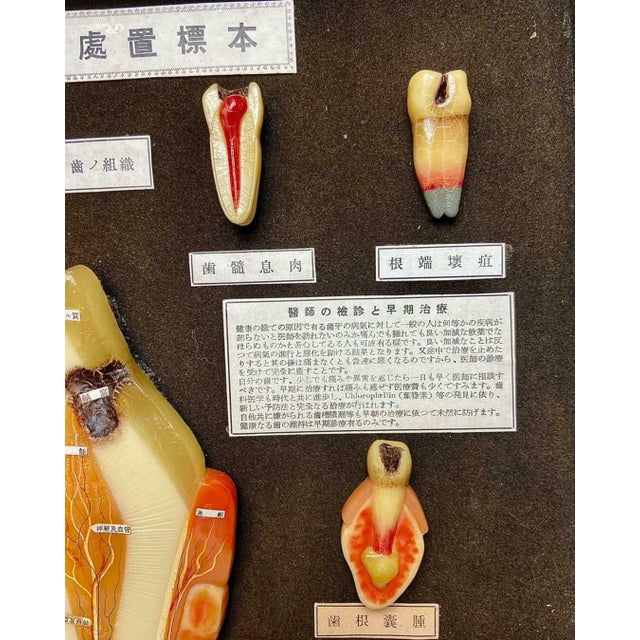 Japanese Dental Teaching Display with Anatomical Models, 1920s For Sale - Image 10 of 18