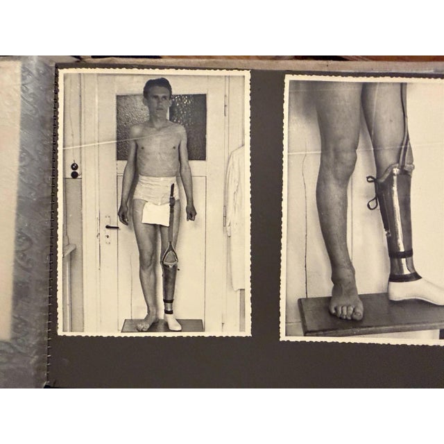 Orthopedics, Prostheses, Wooden Leg, 1930s, Photography For Sale - Image 3 of 13