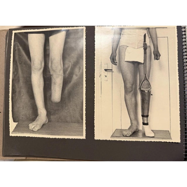 Orthopedics, Prostheses, Wooden Leg, 1930s, Photography For Sale - Image 4 of 13