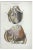 Ottavio Muzzi, Heart Diseases, Lithograph, 1843 For Sale