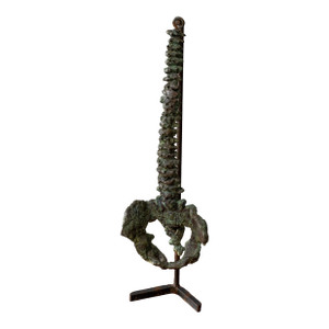 Cast Bronze Spinal Sculpture