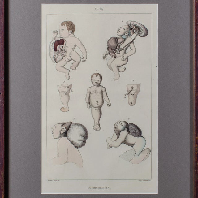 Monstruosites, Engravings From Isidore Geoffrey Sainte-Hilaire, Paris C. 1832 - Set of 4 For Sale - Image 12 of 13