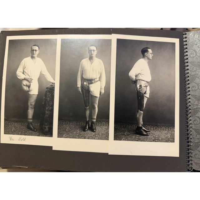 Orthopedics, Prostheses, Wooden Leg, 1930s, Photography For Sale - Image 7 of 13