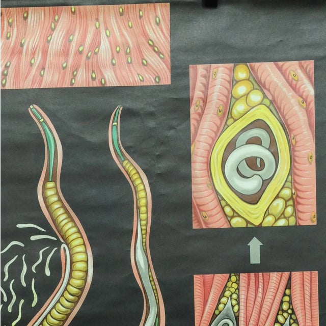 Trichina Rollable Poster Print Wall Chart by Jung Koch Quentell For Sale - Image 3 of 6