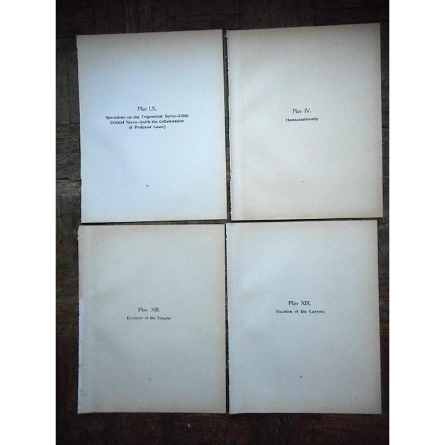 Authentic Antique Lithographs-Surgical Tools-1906-Set of 4 For Sale In Cincinnati - Image 6 of 7