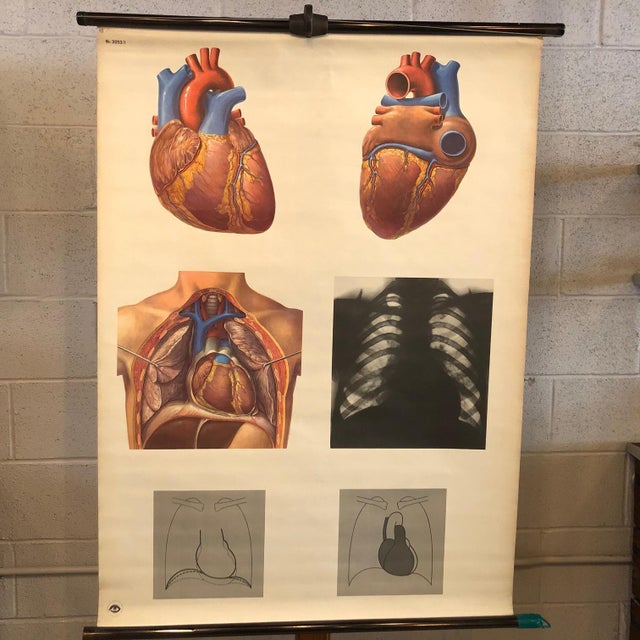 German, educational, anatomical, roll-up, chart depicting the heart, Das Herz from the Deutsches Hygiene Museum, Dresden...