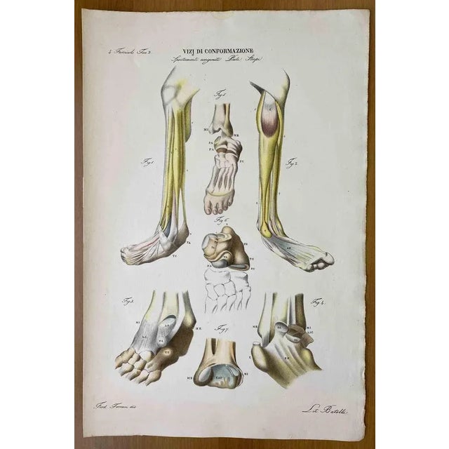 Conformation Defects is a lithograph hand colored by Ottavio Muzzi for the edition of Antoine Chazal, Human Anatomy,...