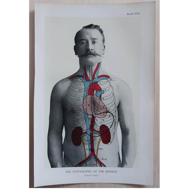 Vintage Medical Prints, 1900, Set of 8, Paper For Sale - Image 4 of 10