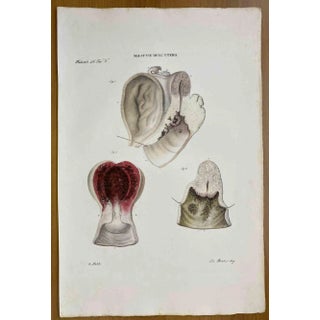 Ottavio Muzzi, Diseases of Uterus, Lithograph, 1843 For Sale