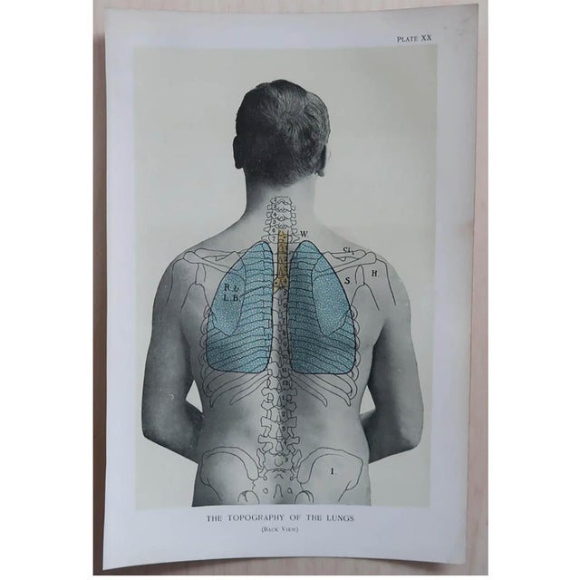 Vintage Medical Prints, 1900, Set of 8, Paper For Sale - Image 3 of 10