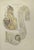 Bowel Diseases is a lithograph hand colored by Ottavio Muzzi for the edition of Antoine Chazal, Human Anatomy, Printers...