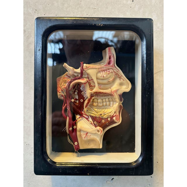 Extremely rare antique display cabinet (c. 1910) containing a three-dimensional anatomical relief wax model of the head....