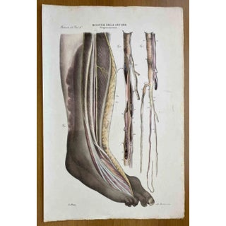 Ottavio Muzzi, Diseases of the Arteries, Lithograph, 1843 For Sale