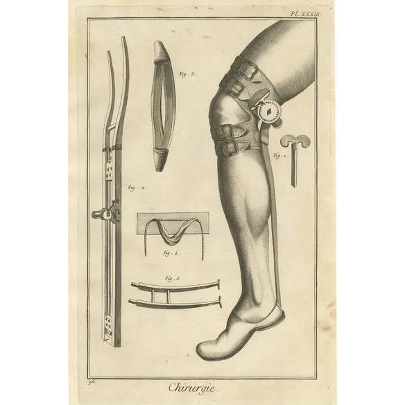 D. Diderot, Medical Print, 1760, Paper For Sale