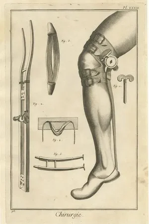 D. Diderot, Medical Print, 1760, Paper
