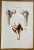 Bone Diseases is a lithograph hand colored by Ottavio Muzzi for the edition of Antoine Chazal, Human Anatomy, Printers...