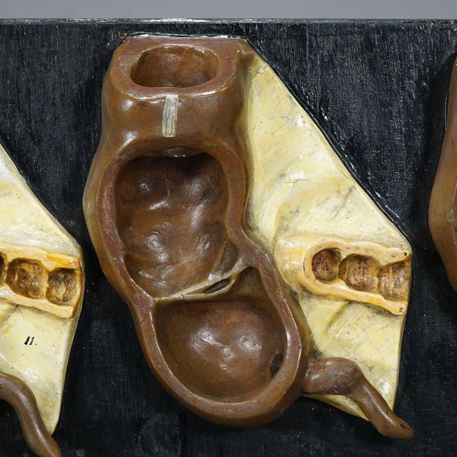Antique Teaching Model Stages of the Appendix, 1900s For Sale - Image 3 of 6