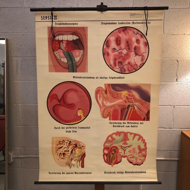 German, educational, anatomical, roll-up, chart Sepsis II Medical Study chart the depicting the stages of the bacterial...