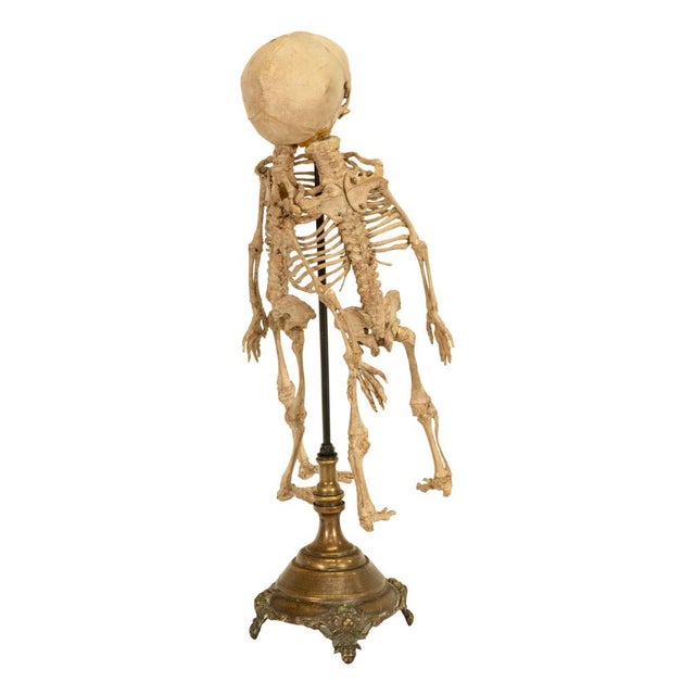 Antique 19thC Anatomical Conjoined Syncephalus Twins Skeleton Medical Model 1860 For Sale - Image 12 of 17