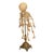 Antique 19thC Anatomical Conjoined Syncephalus Twins Skeleton Medical Model 1860 For Sale - Image 12 of 17