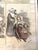 Gray Antique Print, Graphic Weekly, the First Italian Hospital in London, Color, 1889 For Sale - Image 8 of 11