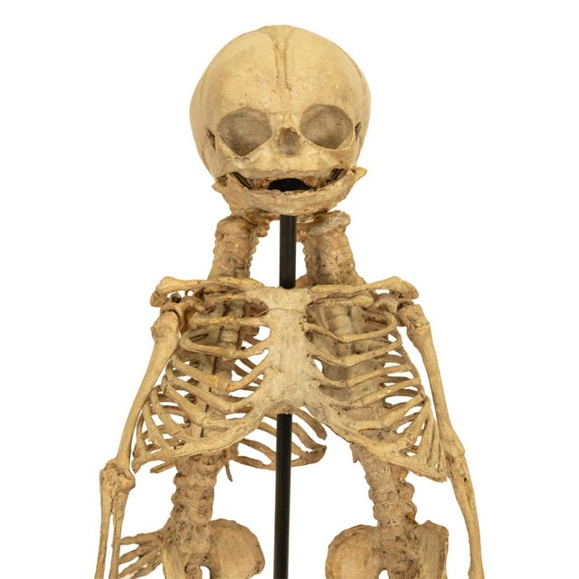 Antique 19thC Anatomical Conjoined Syncephalus Twins Skeleton Medical Model 1860 For Sale - Image 17 of 17