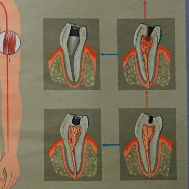 Metal Healthy Teeth Jaw Head Human Body Poster Rollable Wall Chart Print For Sale - Image 7 of 8