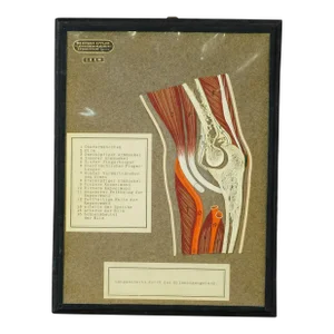 Antique Scientific Visual Aid - Bone Cut of the Human Elbow