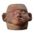 Rare Pre-Colonial Moche Portrait Head Vessel With Tumor and Facial Paralysis (Circa a.d. 200-500) For Sale