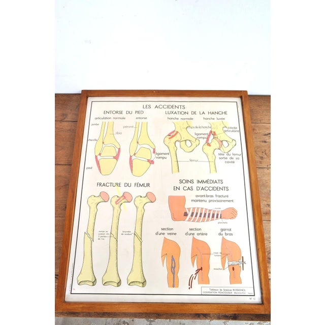 Vintage Double Sided School Posters in Frame of the Human Body, 1950s For Sale - Image 13 of 18