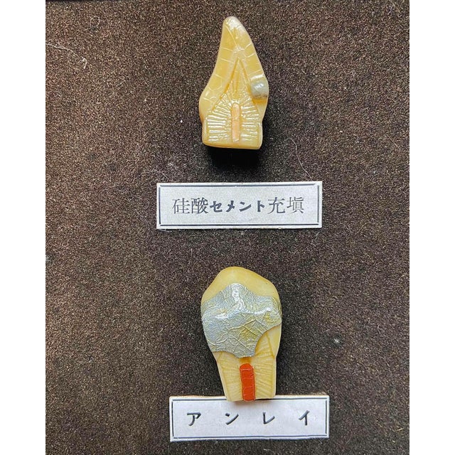 1920s Japanese Dental Teaching Display with Anatomical Models, 1920s For Sale - Image 5 of 18