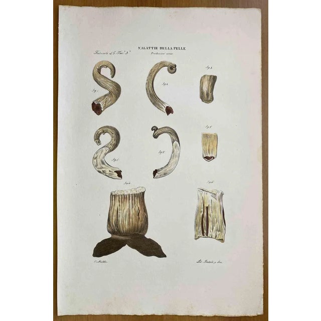 Ottavio Muzzi, Diseases of Skin, Lithograph, 1843 For Sale