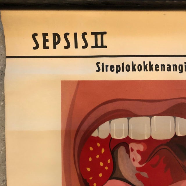 Mid 20th Century German Educational Anatomical Sepsis Study Chart For Sale - Image 4 of 12